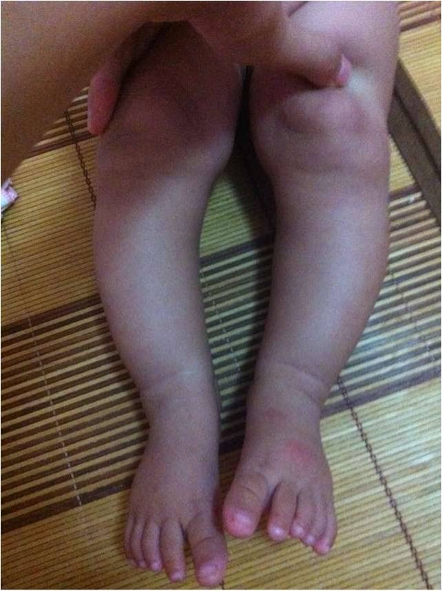 宝宝脚踝弯图片图片