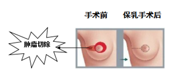 da19250c92ba408183f9c0598bfba542.png